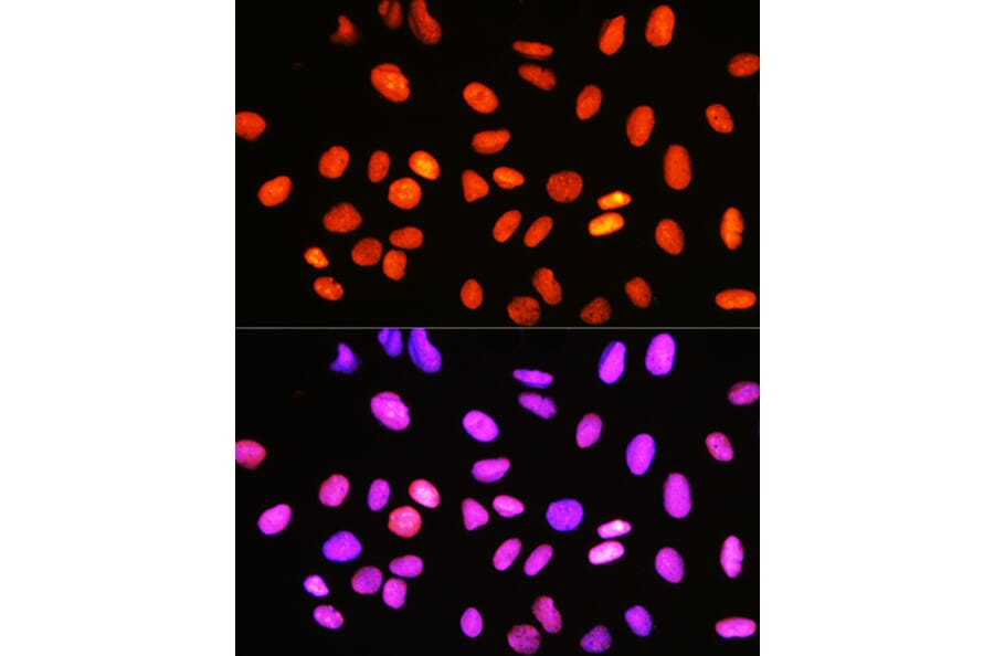 Immunofluorescence - Anti-Topoisomerase I Antibody [ARC0708] (A307759) - Antibodies.com