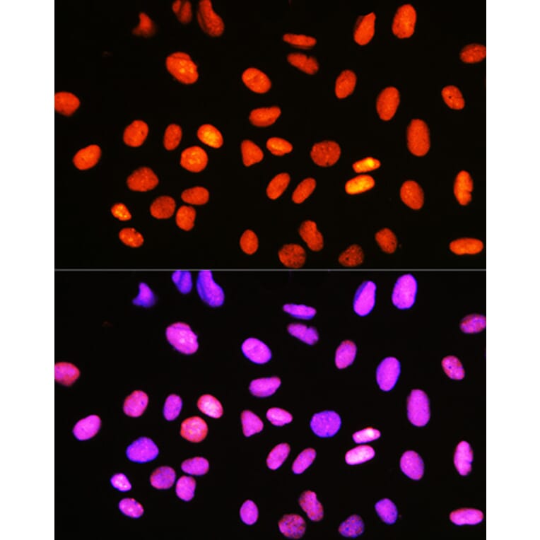 Immunofluorescence - Anti-Topoisomerase I Antibody [ARC0708] (A307759) - Antibodies.com