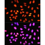 Immunofluorescence - Anti-Topoisomerase I Antibody [ARC0708] (A307759) - Antibodies.com