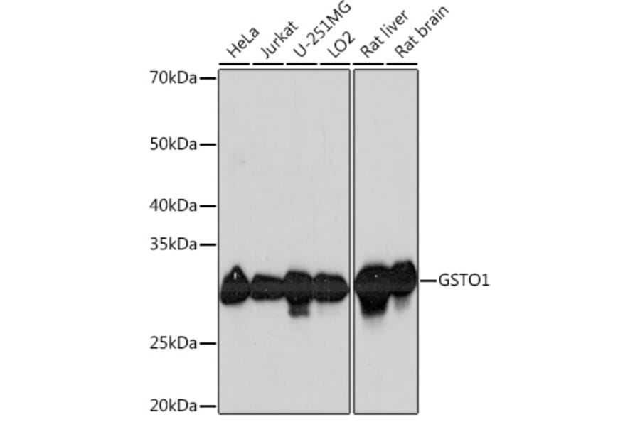 Western Blot - Anti-glutathione S transferase Omega 1/p28 Antibody [ARC1128] (A307761) - Antibodies.com