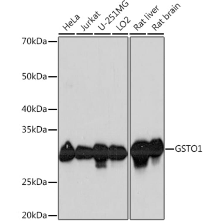 Western Blot - Anti-glutathione S transferase Omega 1/p28 Antibody [ARC1128] (A307761) - Antibodies.com
