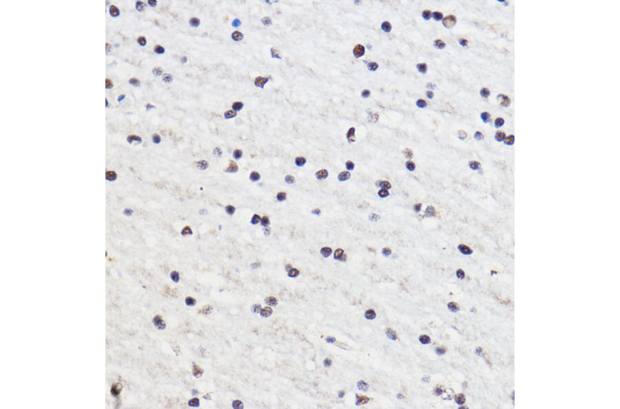 Immunohistochemistry - Anti-Gtf3c3 Antibody (A307763) - Antibodies.com