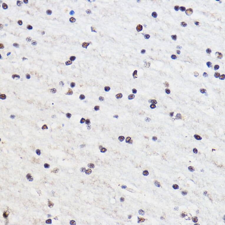 Immunohistochemistry - Anti-Gtf3c3 Antibody (A307763) - Antibodies.com