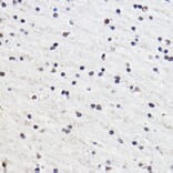Immunohistochemistry - Anti-Gtf3c3 Antibody (A307763) - Antibodies.com