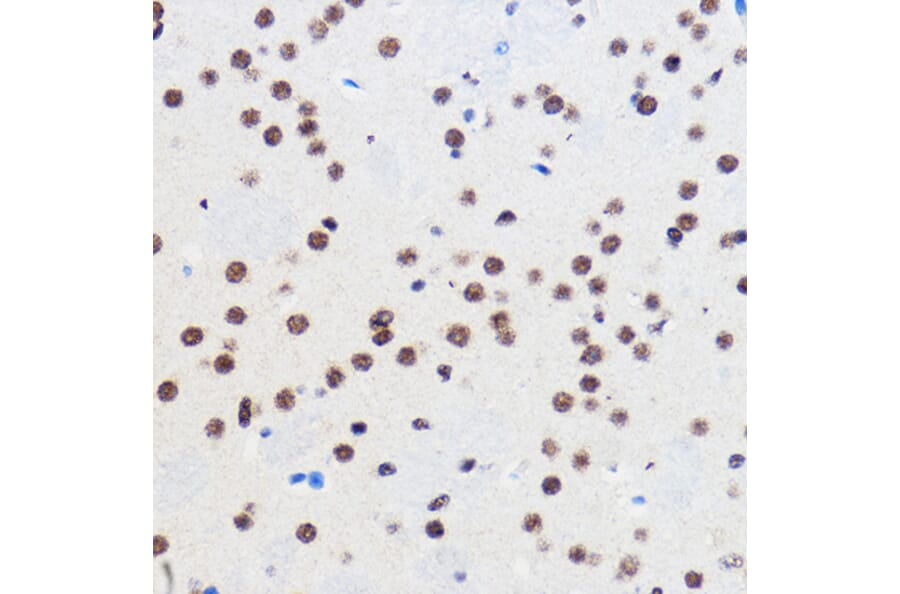 Immunohistochemistry - Anti-Gtf3c3 Antibody (A307763) - Antibodies.com