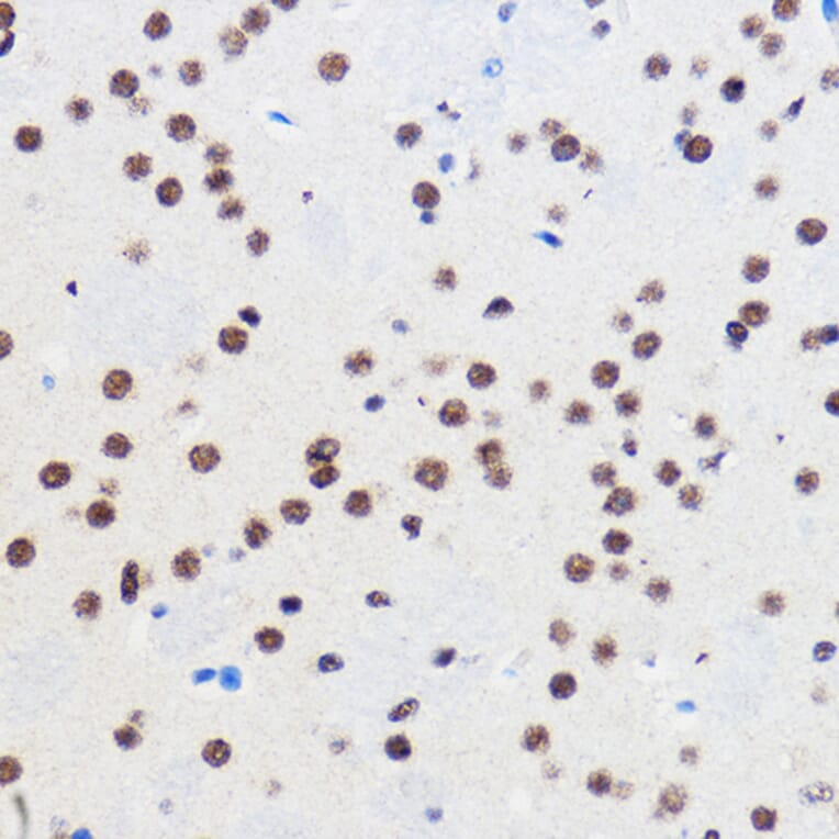 Immunohistochemistry - Anti-Gtf3c3 Antibody (A307763) - Antibodies.com