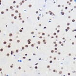 Immunohistochemistry - Anti-Gtf3c3 Antibody (A307763) - Antibodies.com