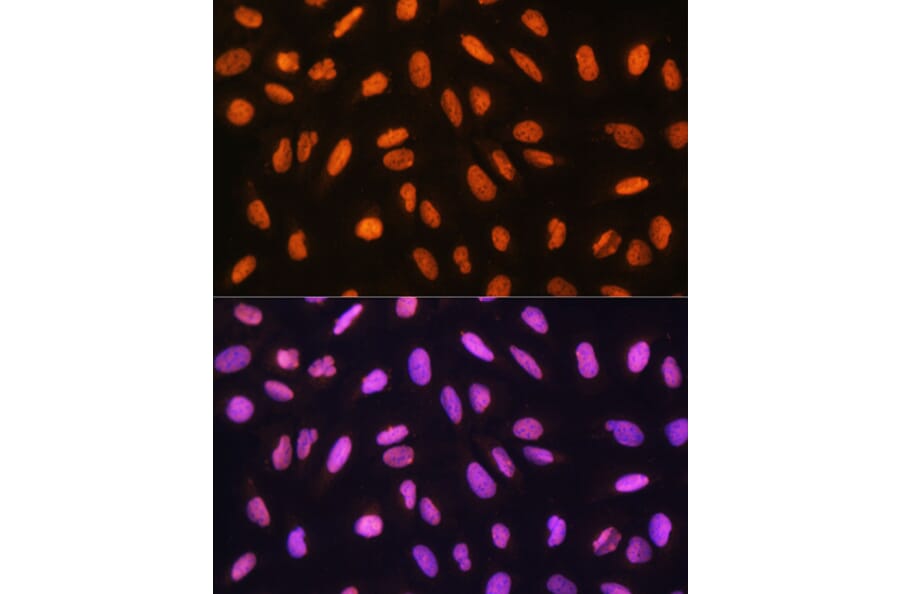 Immunofluorescence - Anti-Gtf3c3 Antibody (A307763) - Antibodies.com