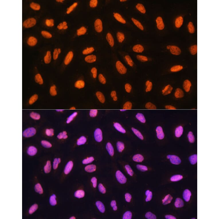 Immunofluorescence - Anti-Gtf3c3 Antibody (A307763) - Antibodies.com