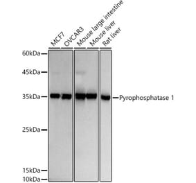 Western Blot - Anti-Pyrophosphatase 1 Antibody [ARC2928] (A307764) - Antibodies.com