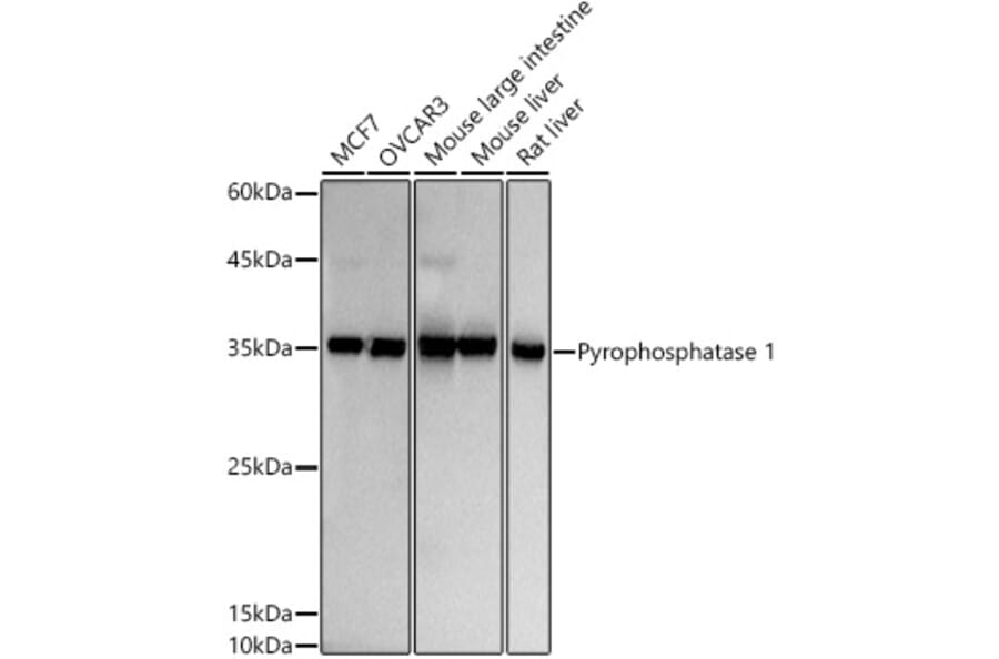 Western Blot - Anti-Pyrophosphatase 1 Antibody [ARC2928] (A307764) - Antibodies.com