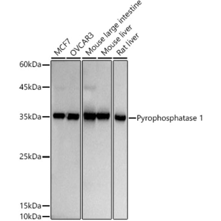 Western Blot - Anti-Pyrophosphatase 1 Antibody [ARC2928] (A307764) - Antibodies.com