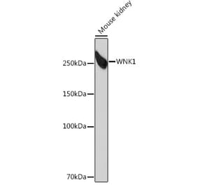 Western Blot - Anti-WNK1 Antibody [ARC0932] (A307765) - Antibodies.com