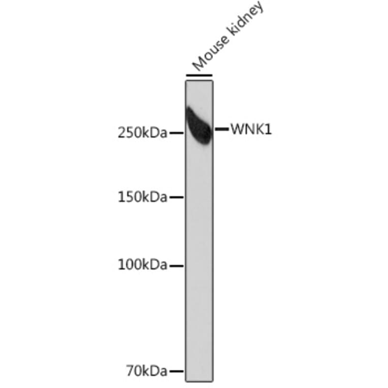 Western Blot - Anti-WNK1 Antibody [ARC0932] (A307765) - Antibodies.com