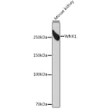 Western Blot - Anti-WNK1 Antibody [ARC0932] (A307765) - Antibodies.com
