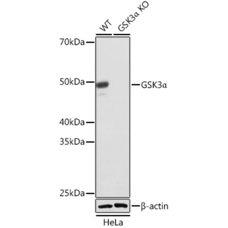 Western Blot - Anti-GSK3 alpha Antibody [ARC0462] (A307767) - Antibodies.com