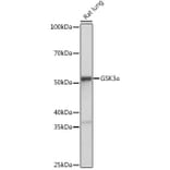 Western Blot - Anti-GSK3 alpha Antibody [ARC0462] (A307767) - Antibodies.com