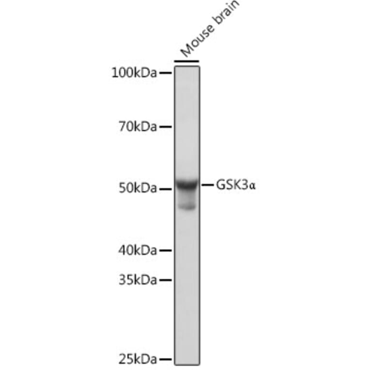 Western Blot - Anti-GSK3 alpha Antibody [ARC0462] (A307767) - Antibodies.com