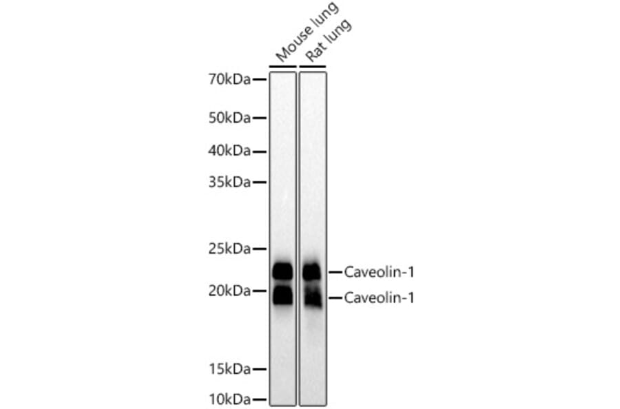 Western Blot - Anti-Caveolin 1 Antibody [ARC50848] (A307768) - Antibodies.com