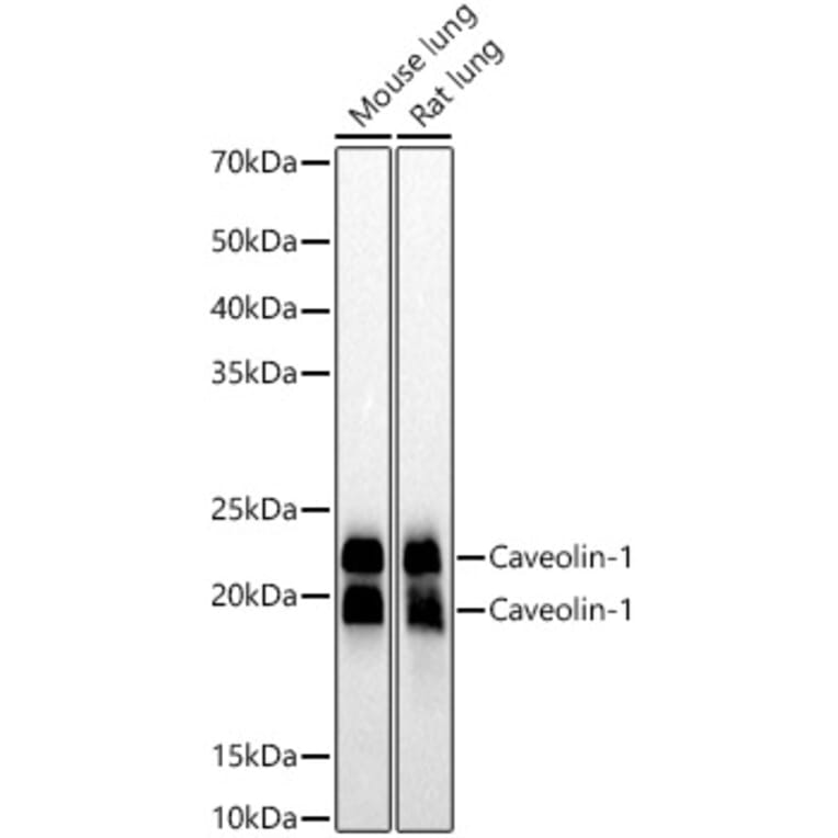 Western Blot - Anti-Caveolin 1 Antibody [ARC50848] (A307768) - Antibodies.com