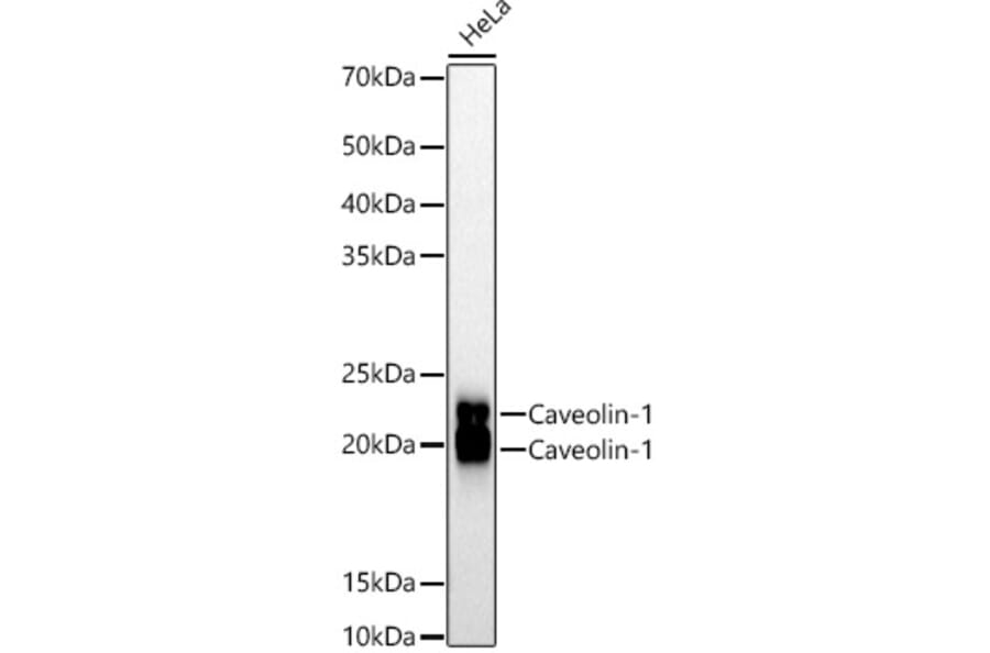 Western Blot - Anti-Caveolin 1 Antibody [ARC50848] (A307768) - Antibodies.com