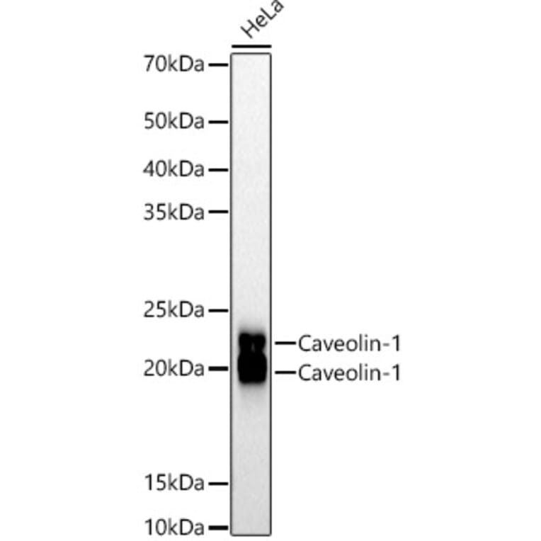 Western Blot - Anti-Caveolin 1 Antibody [ARC50848] (A307768) - Antibodies.com