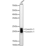 Western Blot - Anti-Caveolin 1 Antibody [ARC50848] (A307768) - Antibodies.com