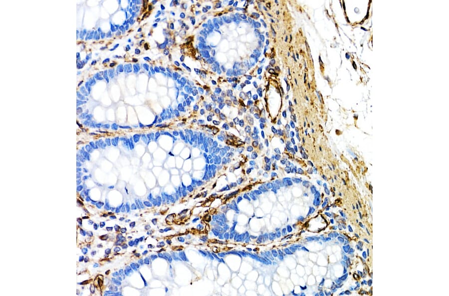 Immunohistochemistry - Anti-Caveolin 1 Antibody [ARC50848] (A307768) - Antibodies.com