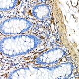 Immunohistochemistry - Anti-Caveolin 1 Antibody [ARC50848] (A307768) - Antibodies.com