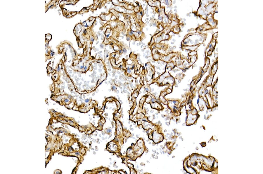Immunohistochemistry - Anti-Caveolin 1 Antibody [ARC50848] (A307768) - Antibodies.com