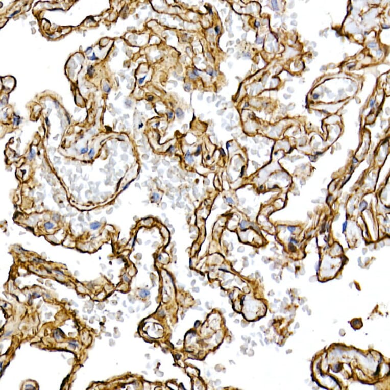 Immunohistochemistry - Anti-Caveolin 1 Antibody [ARC50848] (A307768) - Antibodies.com