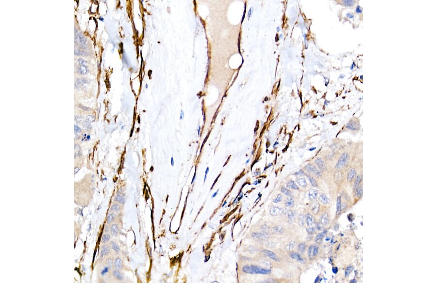 Immunohistochemistry - Anti-Caveolin 1 Antibody [ARC50848] (A307768) - Antibodies.com