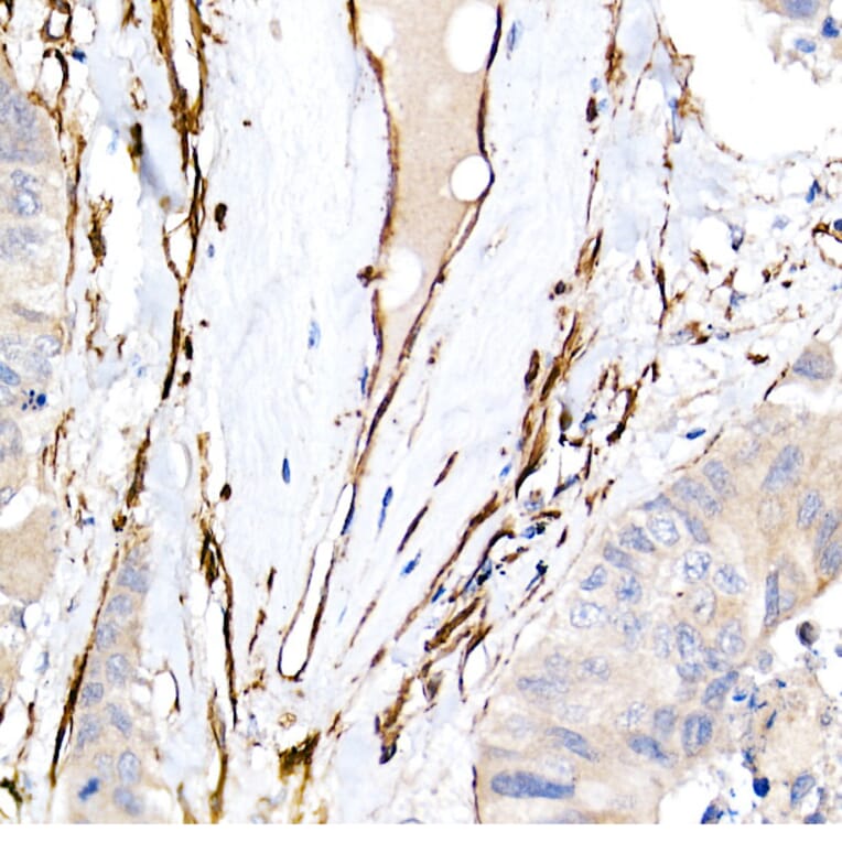 Immunohistochemistry - Anti-Caveolin 1 Antibody [ARC50848] (A307768) - Antibodies.com