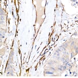 Immunohistochemistry - Anti-Caveolin 1 Antibody [ARC50848] (A307768) - Antibodies.com