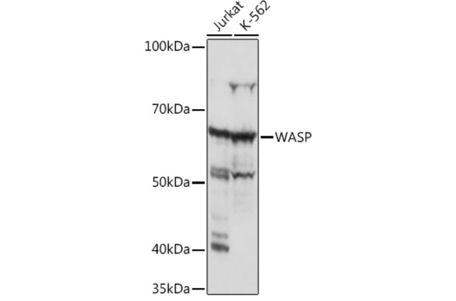 Western Blot - Anti-WASP/Wiskott-Aldrich syndrome protein Antibody [ARC1204] (A307770) - Antibodies.com
