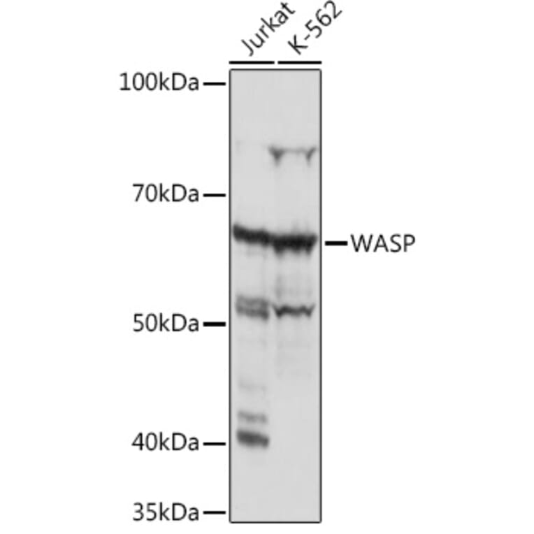 Western Blot - Anti-WASP/Wiskott-Aldrich syndrome protein Antibody [ARC1204] (A307770) - Antibodies.com