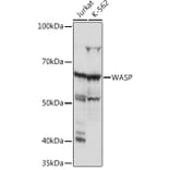 Western Blot - Anti-WASP/Wiskott-Aldrich syndrome protein Antibody [ARC1204] (A307770) - Antibodies.com