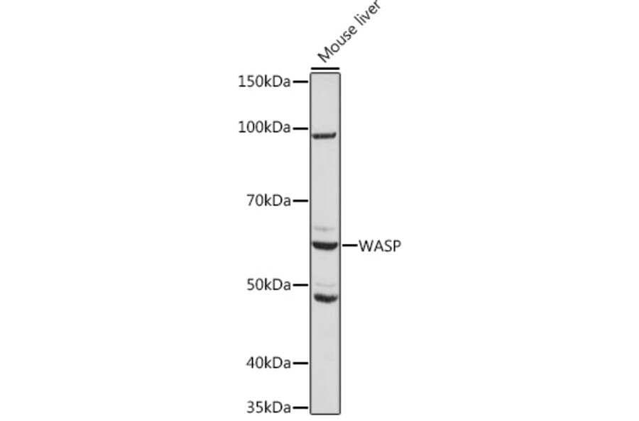 Western Blot - Anti-WASP/Wiskott-Aldrich syndrome protein Antibody [ARC1204] (A307770) - Antibodies.com