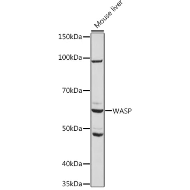 Western Blot - Anti-WASP/Wiskott-Aldrich syndrome protein Antibody [ARC1204] (A307770) - Antibodies.com