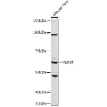Western Blot - Anti-WASP/Wiskott-Aldrich syndrome protein Antibody [ARC1204] (A307770) - Antibodies.com