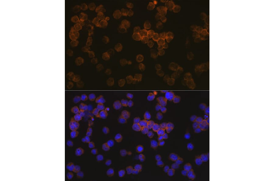Immunofluorescence - Anti-WASP/Wiskott-Aldrich syndrome protein Antibody [ARC1204] (A307770) - Antibodies.com