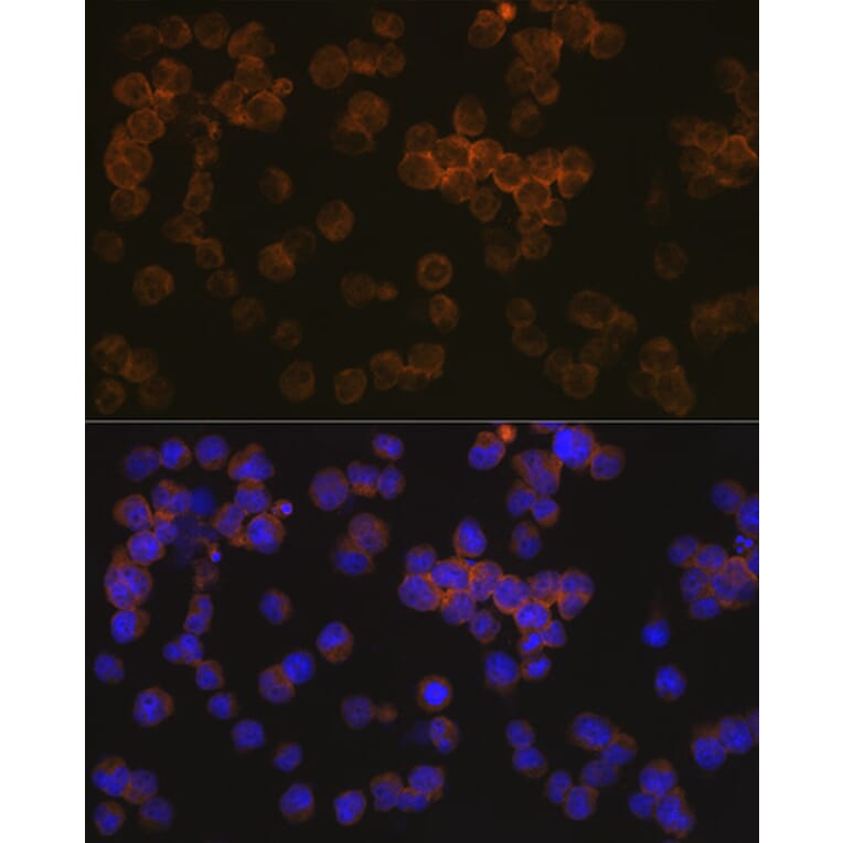 Immunofluorescence - Anti-WASP/Wiskott-Aldrich syndrome protein Antibody [ARC1204] (A307770) - Antibodies.com