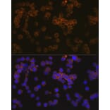 Immunofluorescence - Anti-WASP/Wiskott-Aldrich syndrome protein Antibody [ARC1204] (A307770) - Antibodies.com