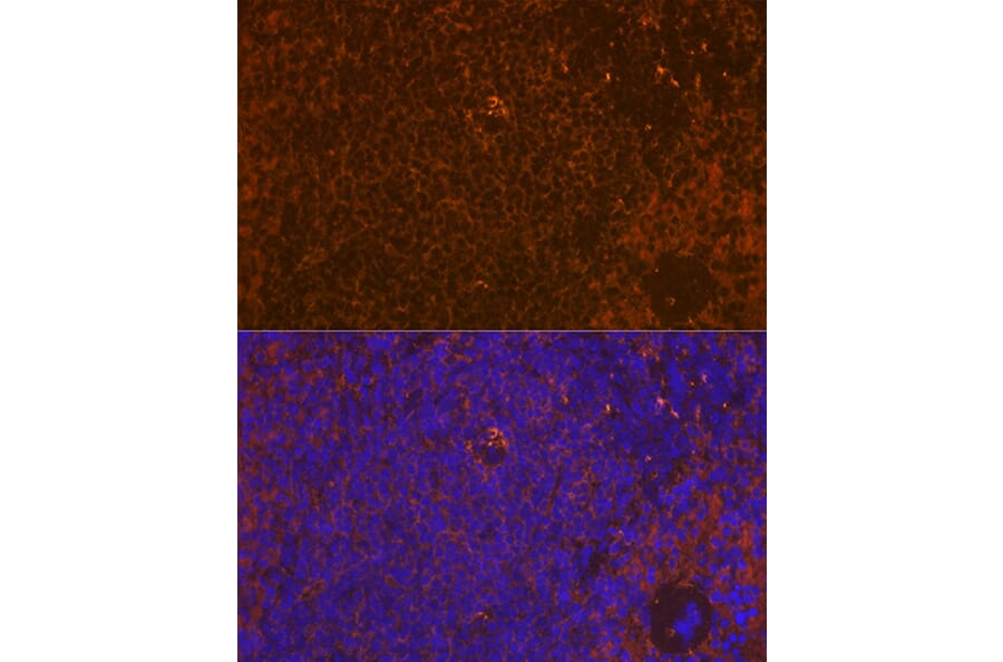 Immunofluorescence - Anti-WASP/Wiskott-Aldrich syndrome protein Antibody [ARC1204] (A307770) - Antibodies.com