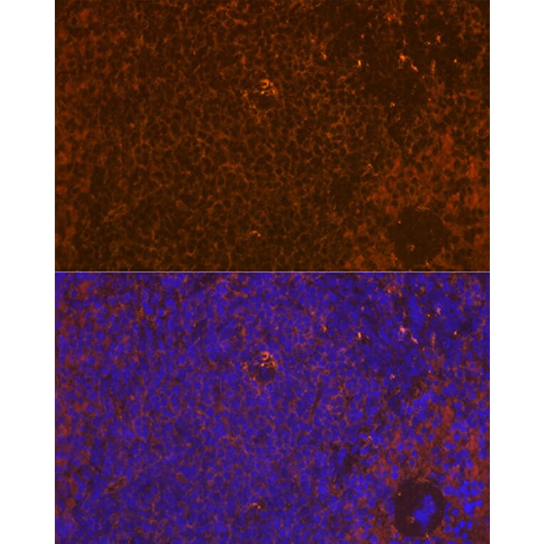 Immunofluorescence - Anti-WASP/Wiskott-Aldrich syndrome protein Antibody [ARC1204] (A307770) - Antibodies.com