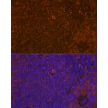 Immunofluorescence - Anti-WASP/Wiskott-Aldrich syndrome protein Antibody [ARC1204] (A307770) - Antibodies.com