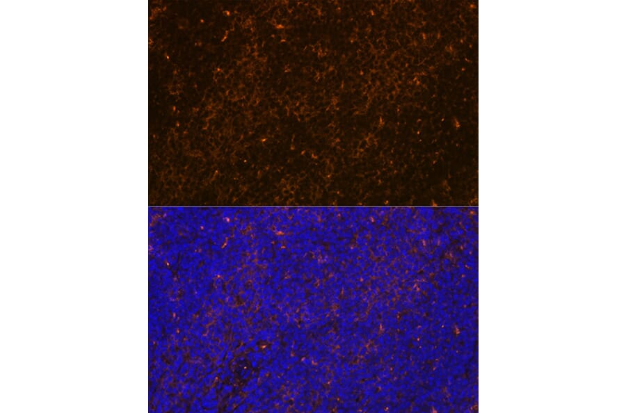 Immunofluorescence - Anti-WASP/Wiskott-Aldrich syndrome protein Antibody [ARC1204] (A307770) - Antibodies.com