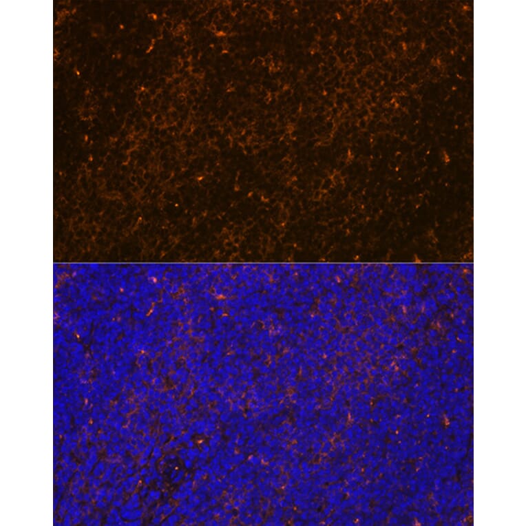 Immunofluorescence - Anti-WASP/Wiskott-Aldrich syndrome protein Antibody [ARC1204] (A307770) - Antibodies.com