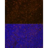 Immunofluorescence - Anti-WASP/Wiskott-Aldrich syndrome protein Antibody [ARC1204] (A307770) - Antibodies.com