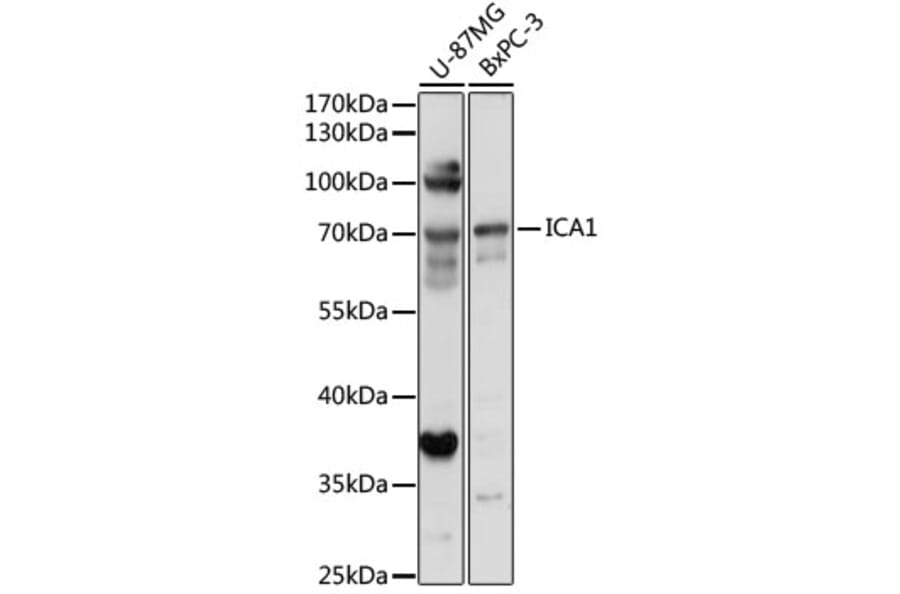 Western Blot - Anti-ICA69 Antibody (A307772) - Antibodies.com